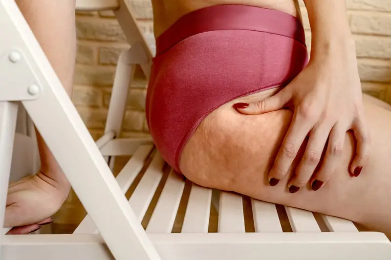 femme avec de la cellulite sur les fesses et les cuisses